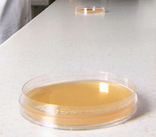 Check the room for mold contamination with diy agar test